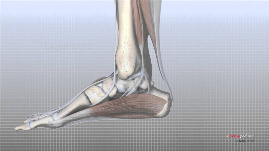 Fractured Ankle JOINT HYPOMOBILITY: NONOPERATIVE MANAGEMENT