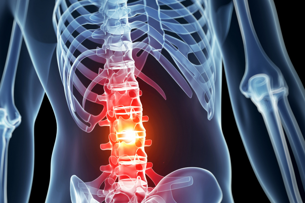 Making Sure Everything’s Spine: Spine Injuries and Treatment Modalities