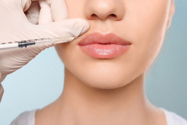 Why Lip Filler Injections Have Become So Popular