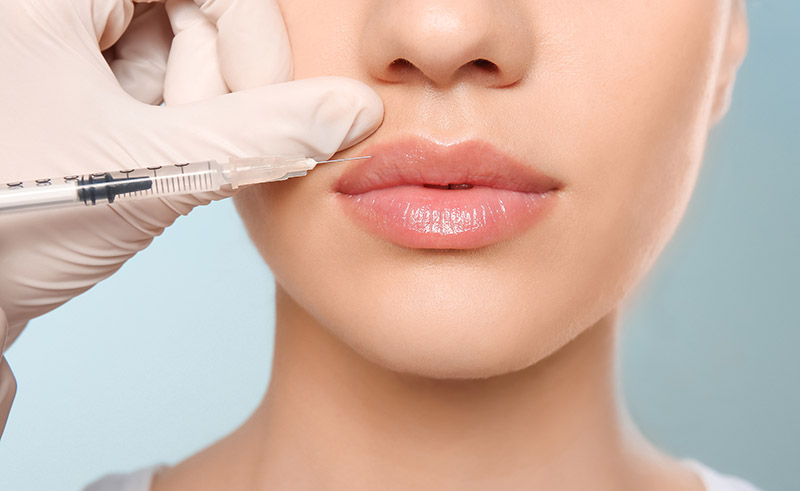 Lip Filler Injections