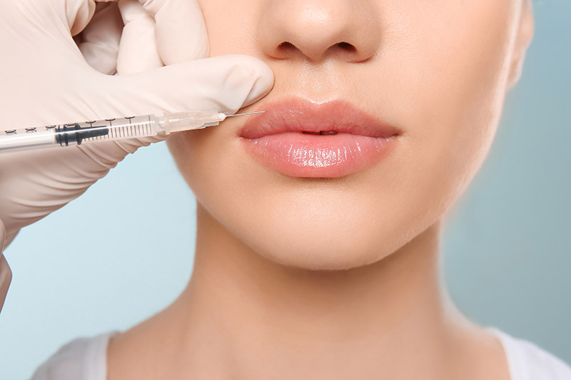 Why Lip Filler Injections Have Become So Popular