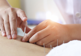Benefits of Acupuncture for Lower Back Pain