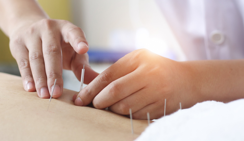 Benefits of Acupuncture for Lower Back Pain