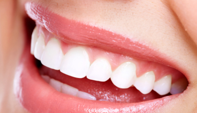 Perfectly Straight Teeth