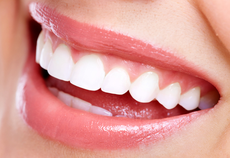 Why Your Perfectly Straight Teeth Didn’t Stay That Way