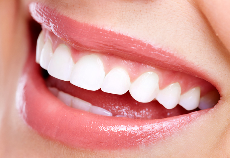 Why Your Perfectly Straight Teeth Didn’t Stay That Way